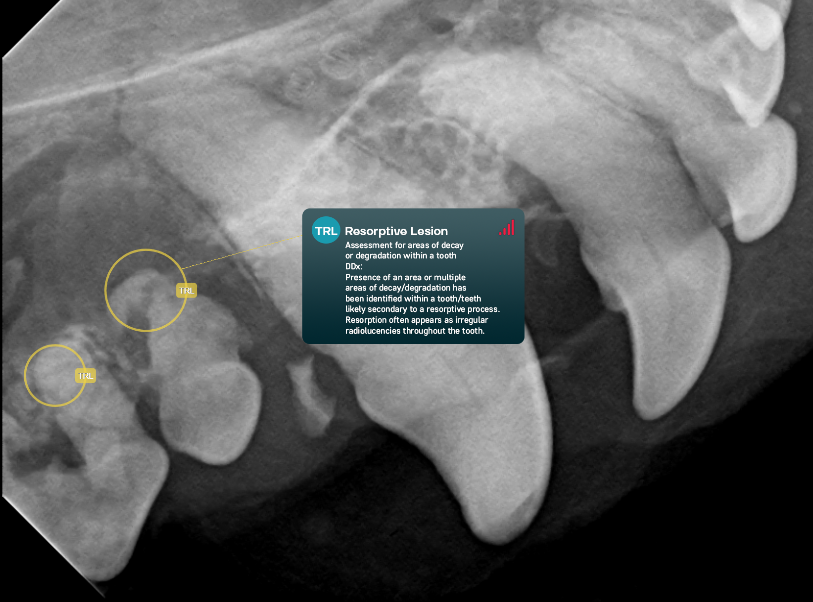 Resorptive Lesion-1